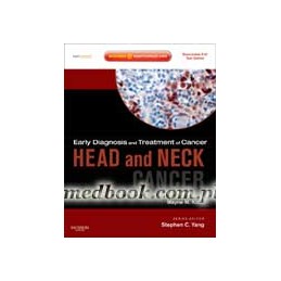 Early Diagnosis and Treatment of Cancer Series: Head and Neck Cancers