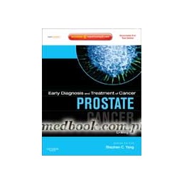 Early Diagnosis and Treatment of Cancer Series: Prostate Cancer