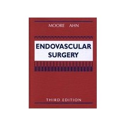 Endovascular Surgery