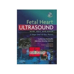 Fetal Heart Ultrasound