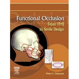 Functional Occlusion