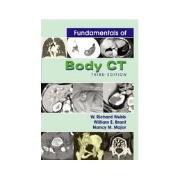 Fundamentals of Body CT