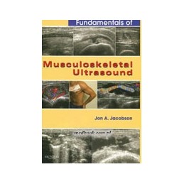 Fundamentals of Musculoskeletal Ultrasound