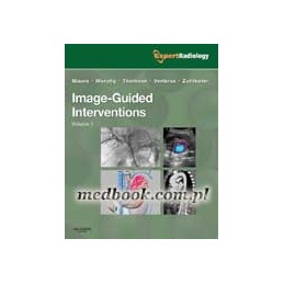 Image-Guided Interventions