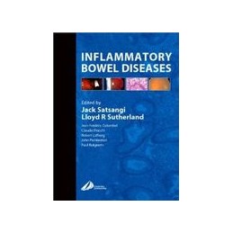 Inflammatory Bowel Diseases