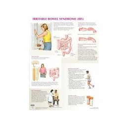 Irritable Bowel Syndrome Chart