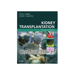 Kidney Transplantation