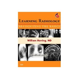 Learning Radiology