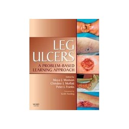 Leg Ulcers