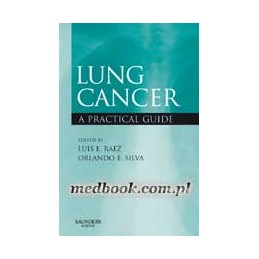 Lung Cancer