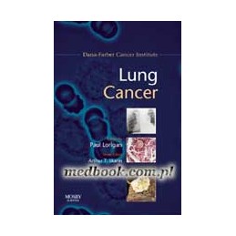 Lung Cancer