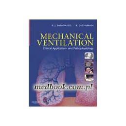 Mechanical Ventilation