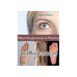 Micro-Acupuncture in Practice