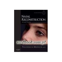 Nasal Reconstruction: Art...