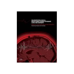 Neurophysiological Monitoring During Intensive Care and Surgery