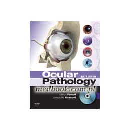 Ocular Pathology