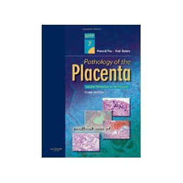 Pathology of the Placenta