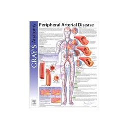 Peripheral Arterial Disease