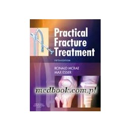 Practical Fracture Treatment