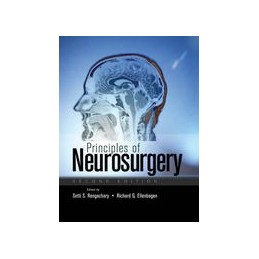 Principles of Neurosurgery