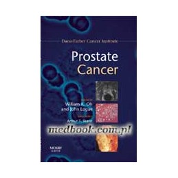 Prostate Cancer