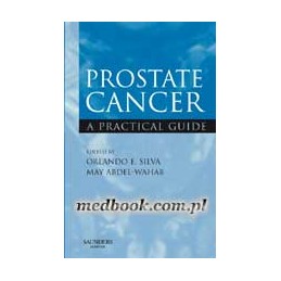 Prostate Cancer