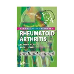 Rheumatoid Arthritis