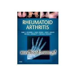 Rheumatoid Arthritis