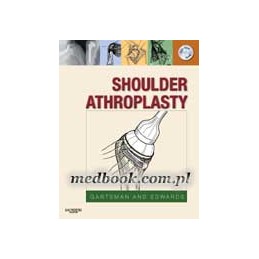 Shoulder Arthroplasty