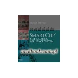 SmartClip Self-Ligating...