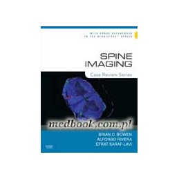 Spine Imaging