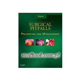 Surgical Pitfalls