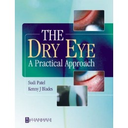 The Dry Eye