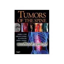 Tumors of the Spine