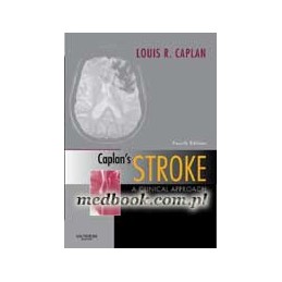 Caplan's Stroke