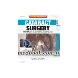 Cataract Surgery