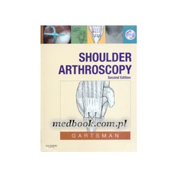 Shoulder Arthroscopy