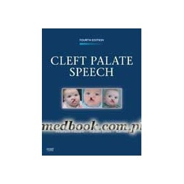 Cleft Palate Speech