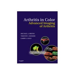 Arthritis in Color