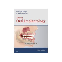 Atlas of Oral Implantology