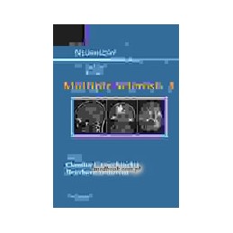 Multiple Sclerosis 3