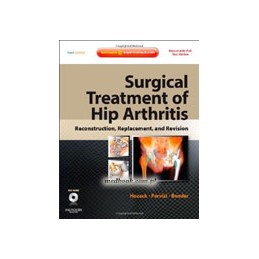 Surgical Treatment of Hip...