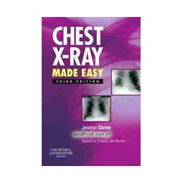 Chest X-Ray Made Easy