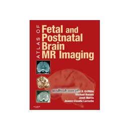 Atlas of Fetal and...