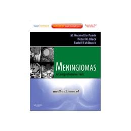 Meningiomas