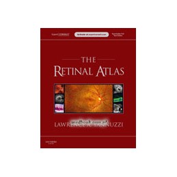 The Retinal Atlas