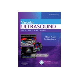 Vascular Ultrasound