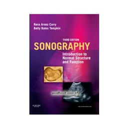 Sonography