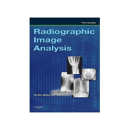 Radiographic Image Analysis