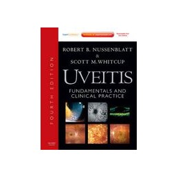 Uveitis